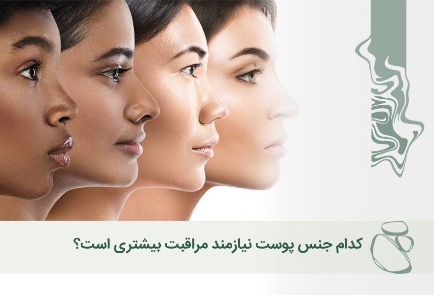 کدام جنس پوست نیازمند مراقبت بیشتری است؟